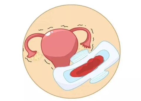 功能性子宮出血的癥狀和治療方法
