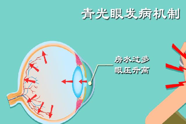 青光眼不能吃食物列表，這6類食物最好不要沾